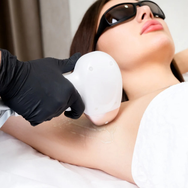 Séance d’épilation définitive au laser à Gignac