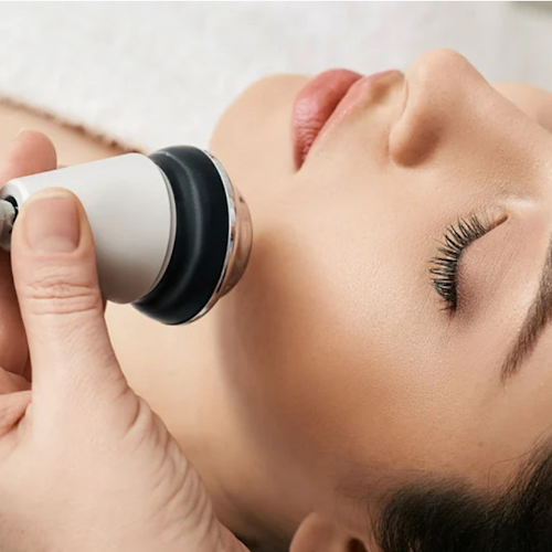 Soin de radiofréquence à Gignac